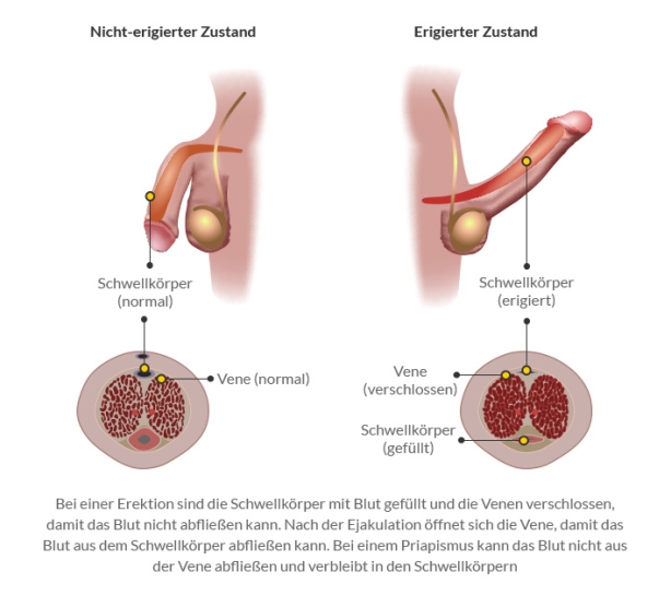 Fragen zur Männergesundheit